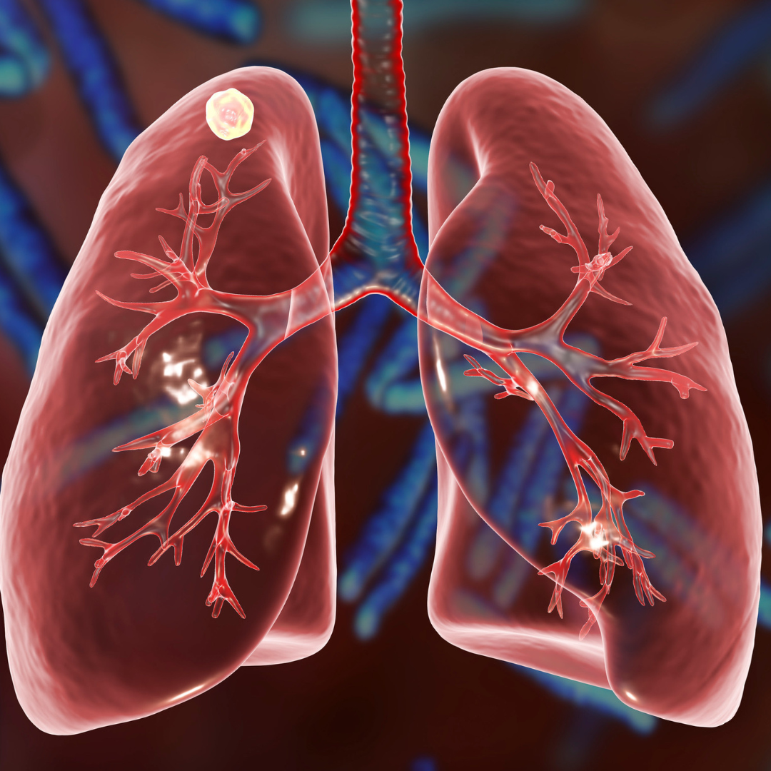 What Causes Respiratory Allergies to Get Worse?
